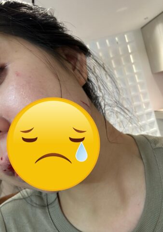 [HOT] Top 99+ sex tôn bằng đăng ảnh hằng du mục mới nhất