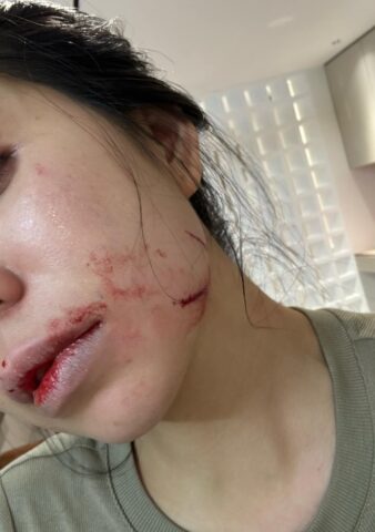 [HOT] Top 99+ sex tôn bằng đăng ảnh hằng du mục mới nhất