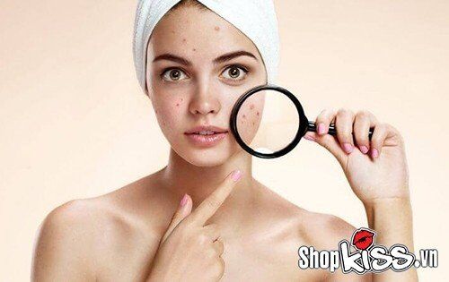 Nguy cơ lây nhiễm bệnh qua tinh dịch khi da mặt có mụn hoặc vết thương hở